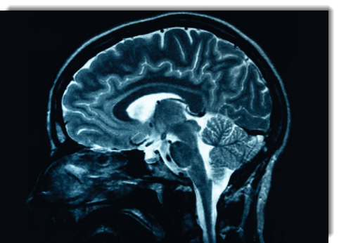 Brain image of xray